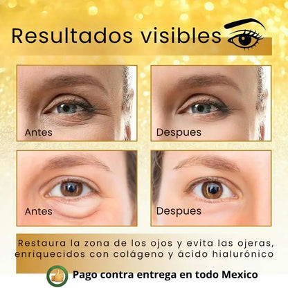 Almohadillas de Gel para Ojos Gold 24K con Colágeno y Ácido Hialurónico
